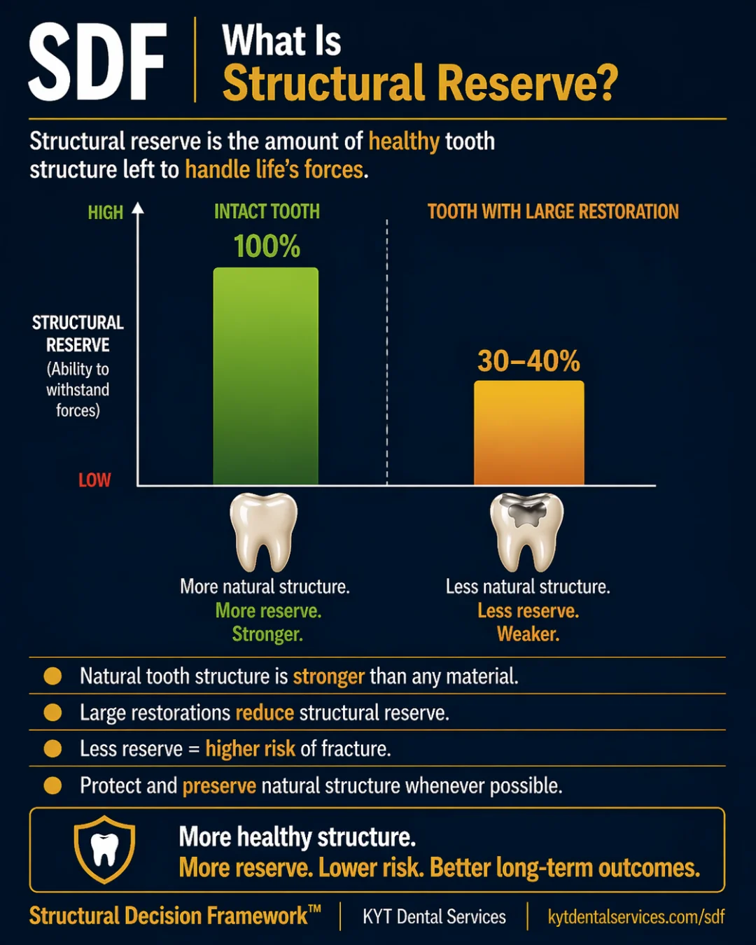 What Is Structural Reserve? — SDF card artwork