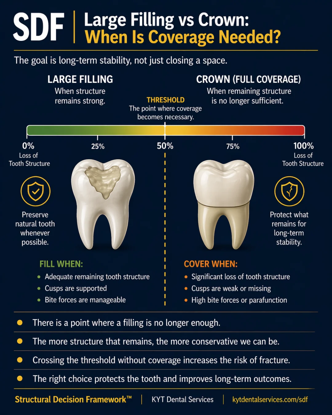 Large Filling vs Crown: When Is Coverage Needed? SDF card artwork