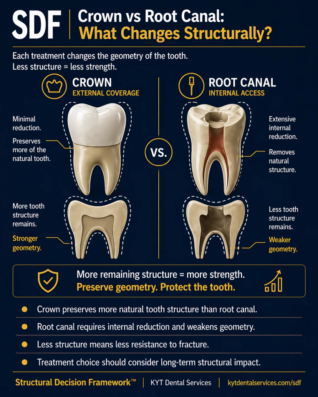 Crown vs Root Canal: What Changes Structurally? SDF card artwork
