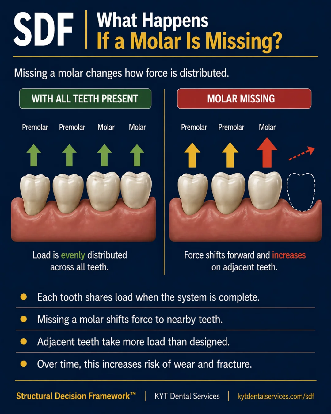 What Happens If a Molar Is Missing? SDF card artwork